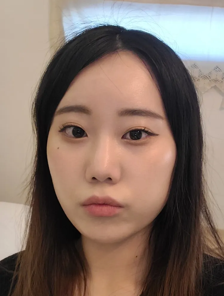 id 病院 - Patient Case Review - 手術前