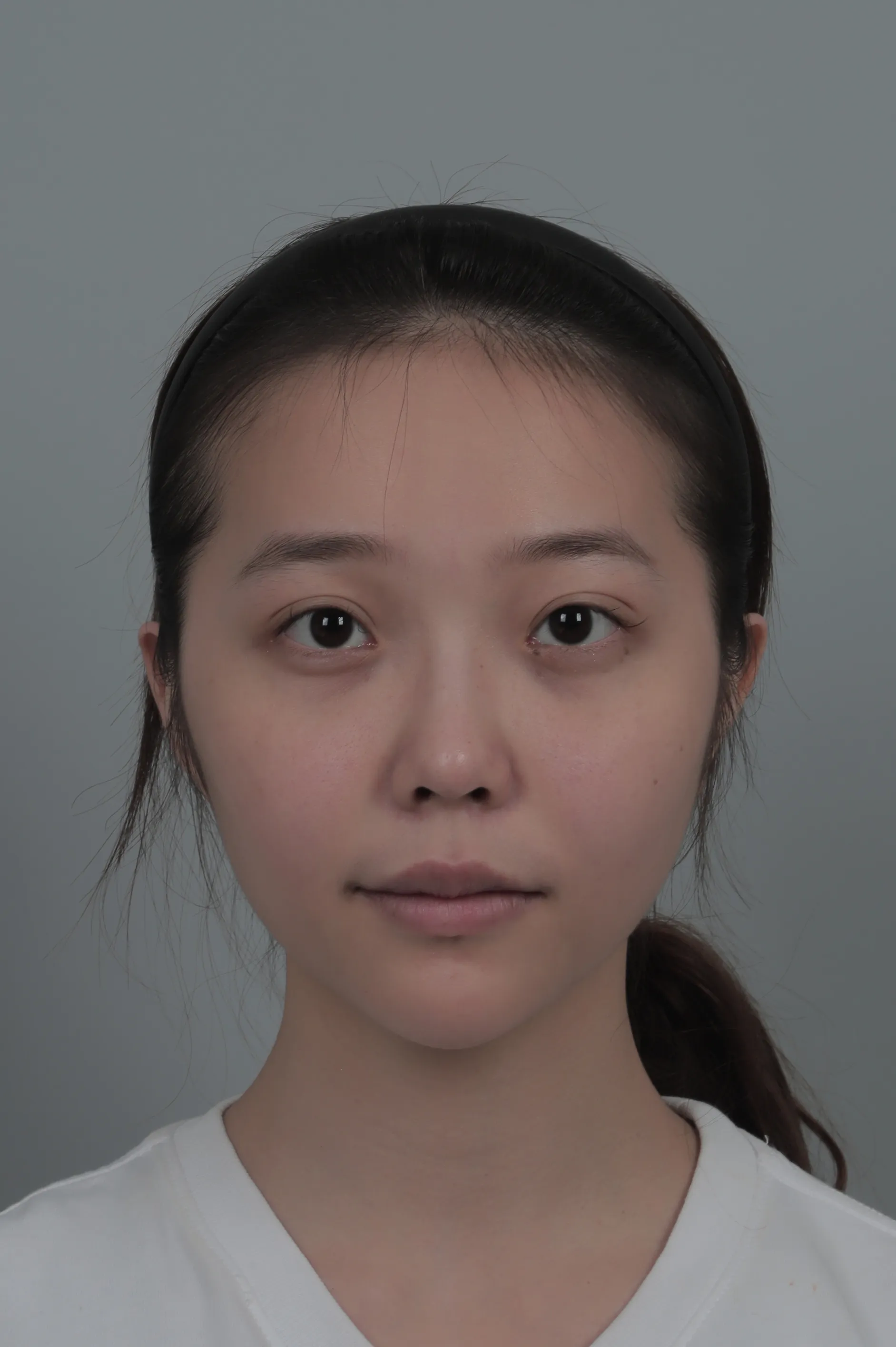 id 病院 - Patient Case Review - 手術前