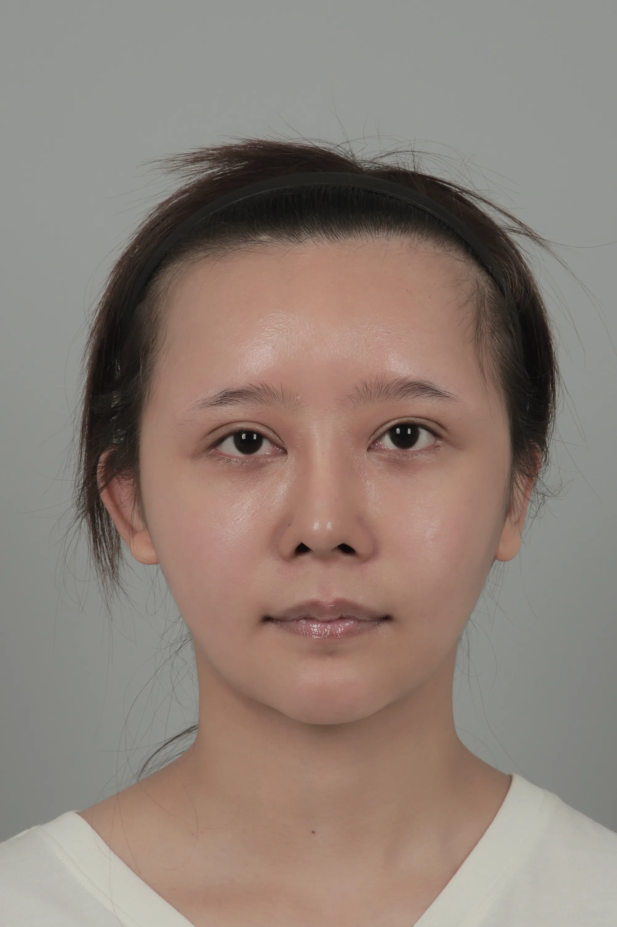 id 病院 - Patient Case Review - 手術前