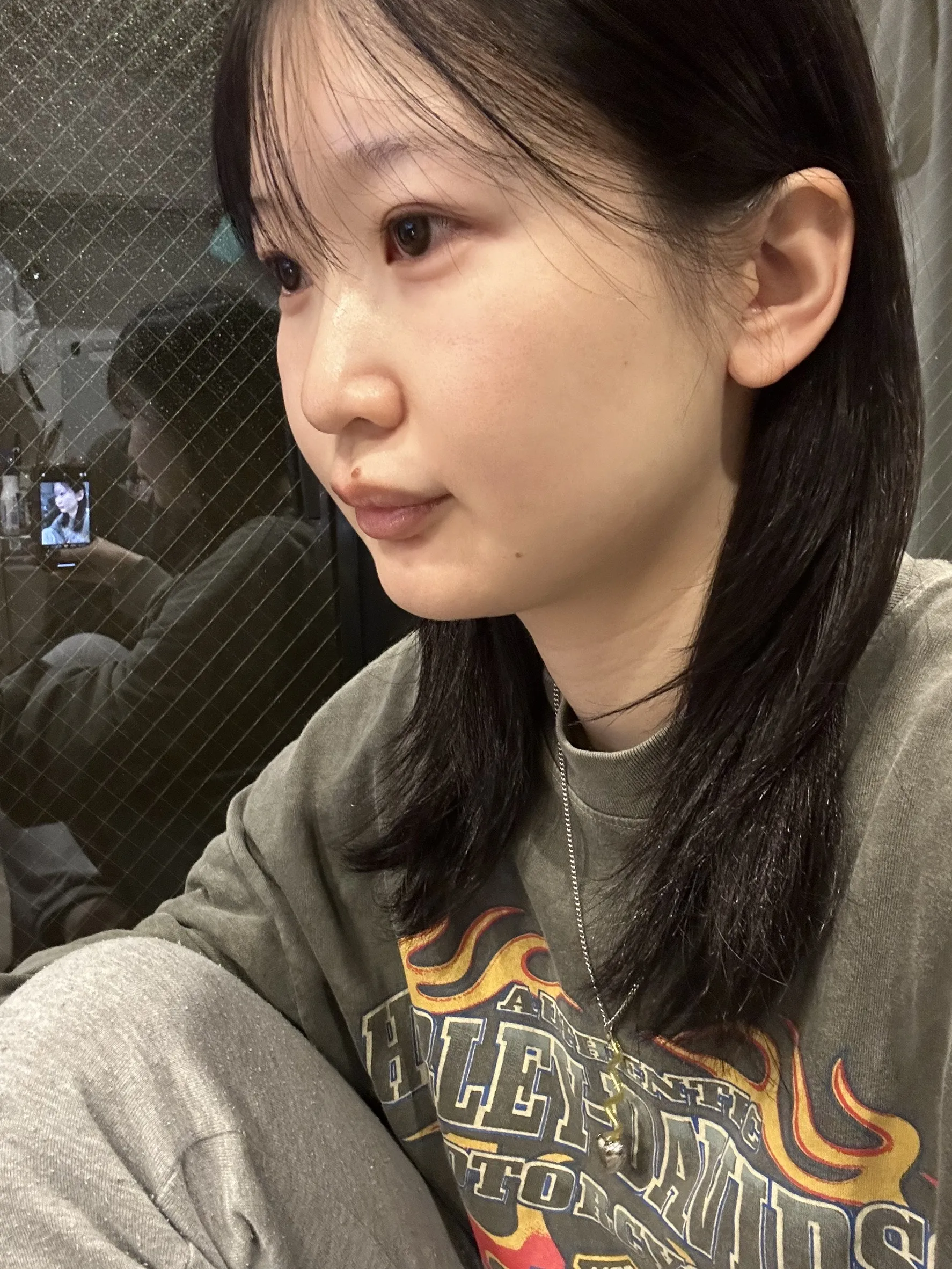 id 病院 - Patient Case Review - 手術前