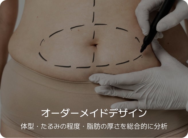 id 病院 - id腹部形成術 - オーダーメイドデザイン