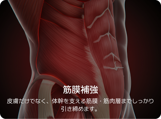 id 病院 - id腹部形成術 - 筋膜補強