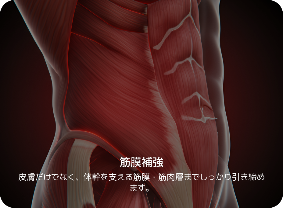 id 病院 - id腹部形成術 - 筋膜補強