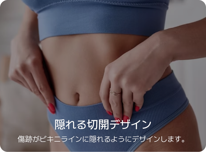 id 病院 - id腹部形成術 - 目立ちにくい切開デザイン