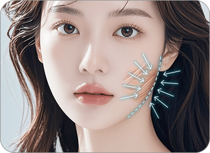 id Hospital - MVP Mandible Reduction - 咬筋縮小