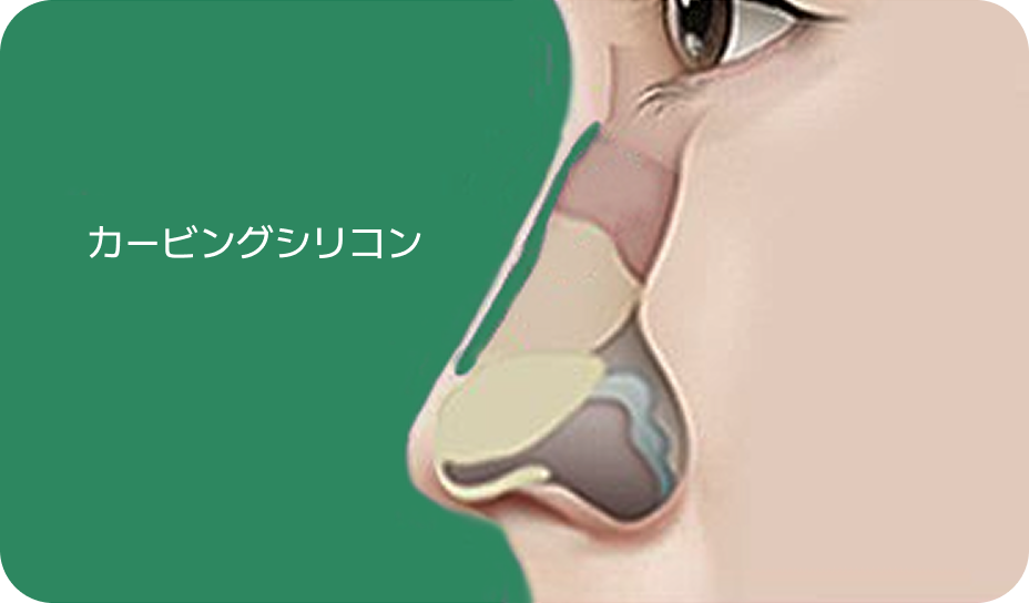 自然で洗練された鼻整形｜id病院