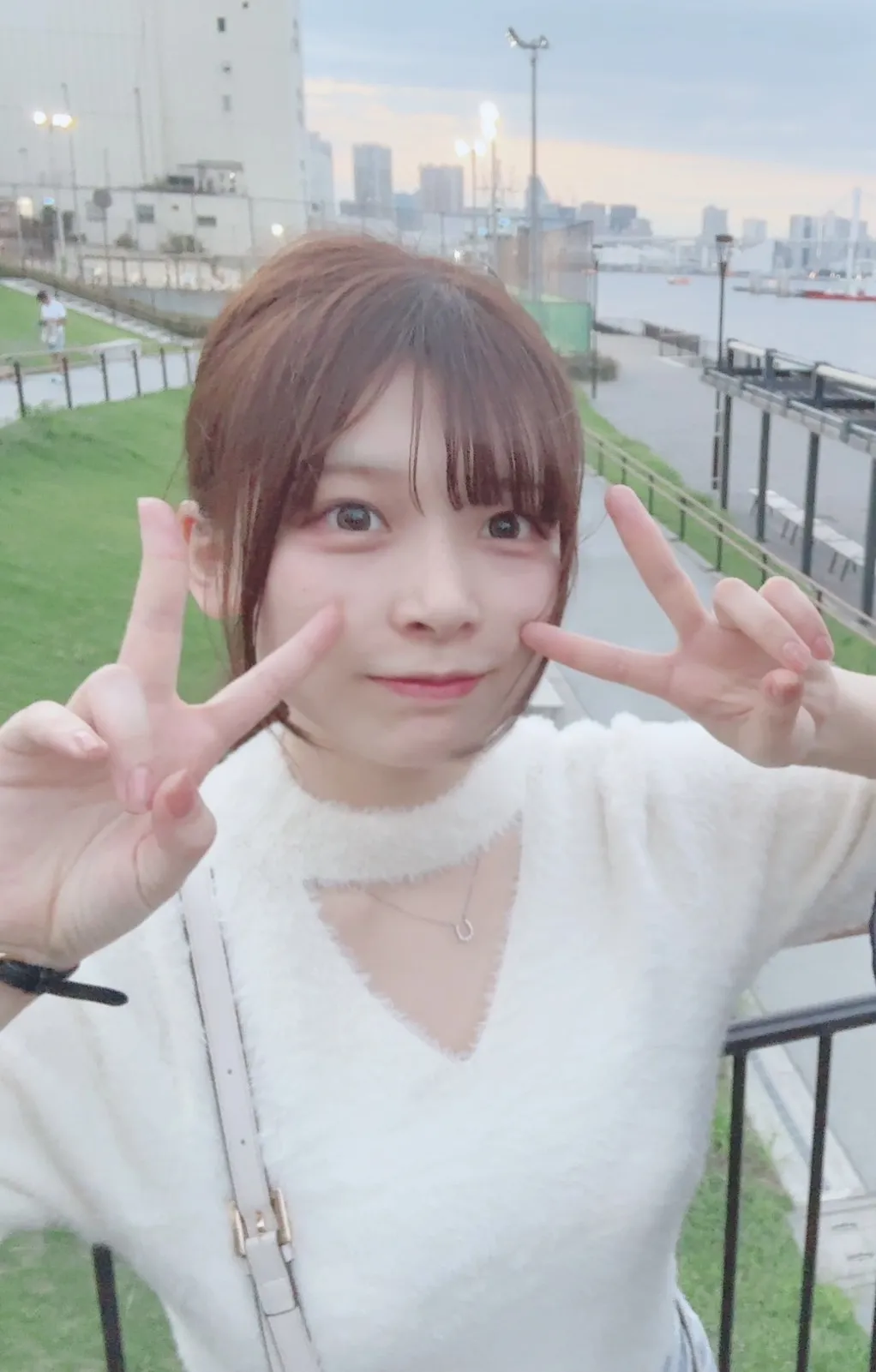 id Hospital - id Real Selfie - 石井ミキ After