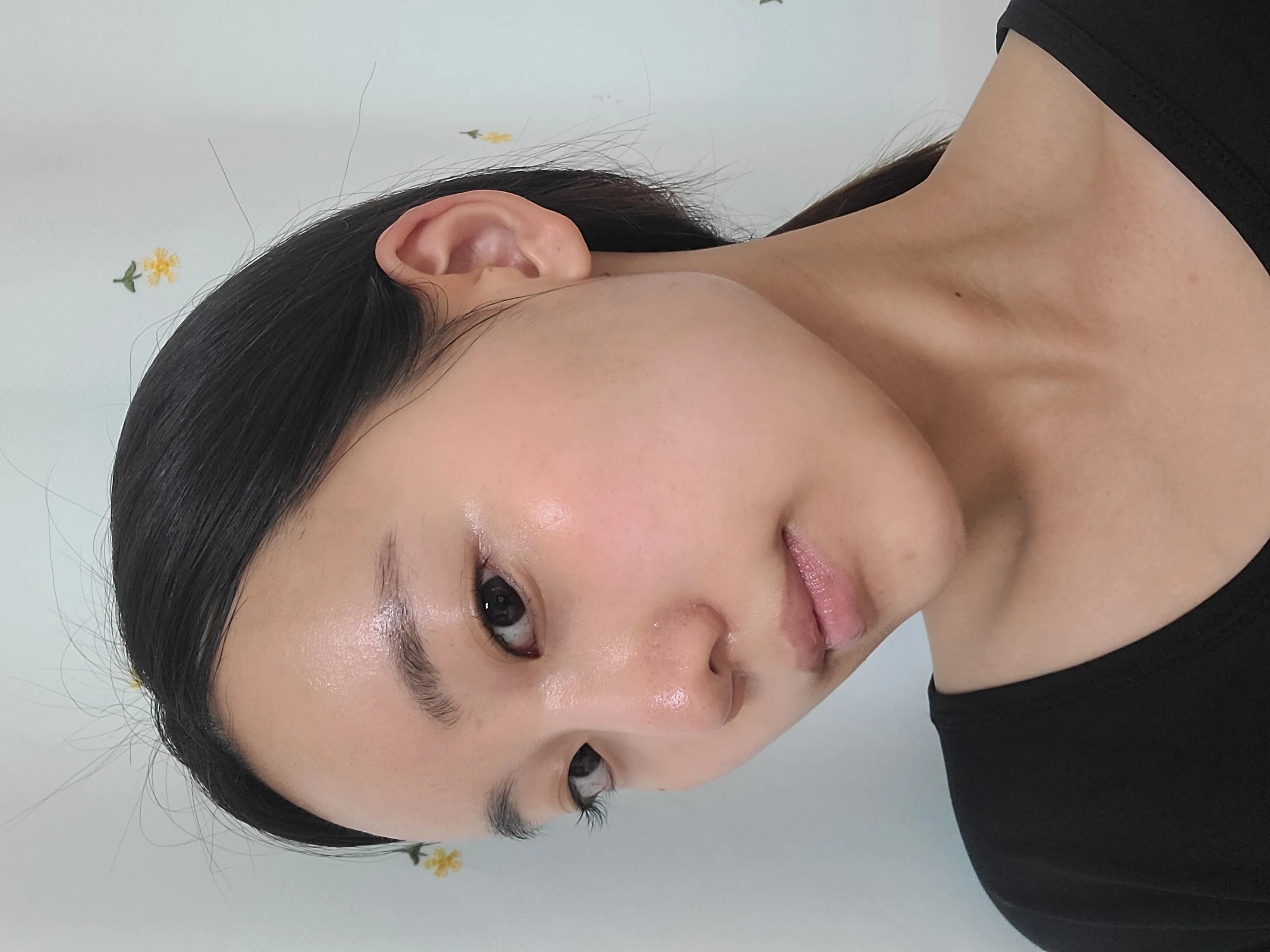 id Hospital - id Real Selfie - 권채림 Before