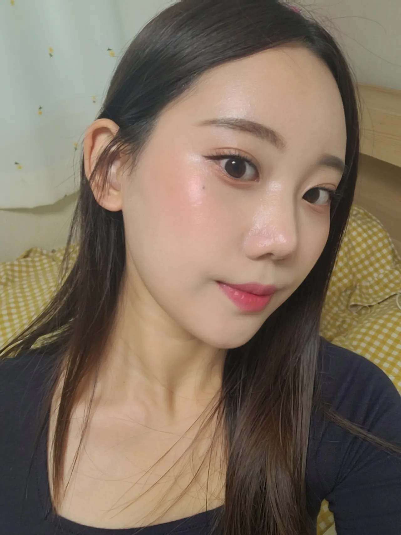 id Hospital - id Real Selfie - 권채림 After