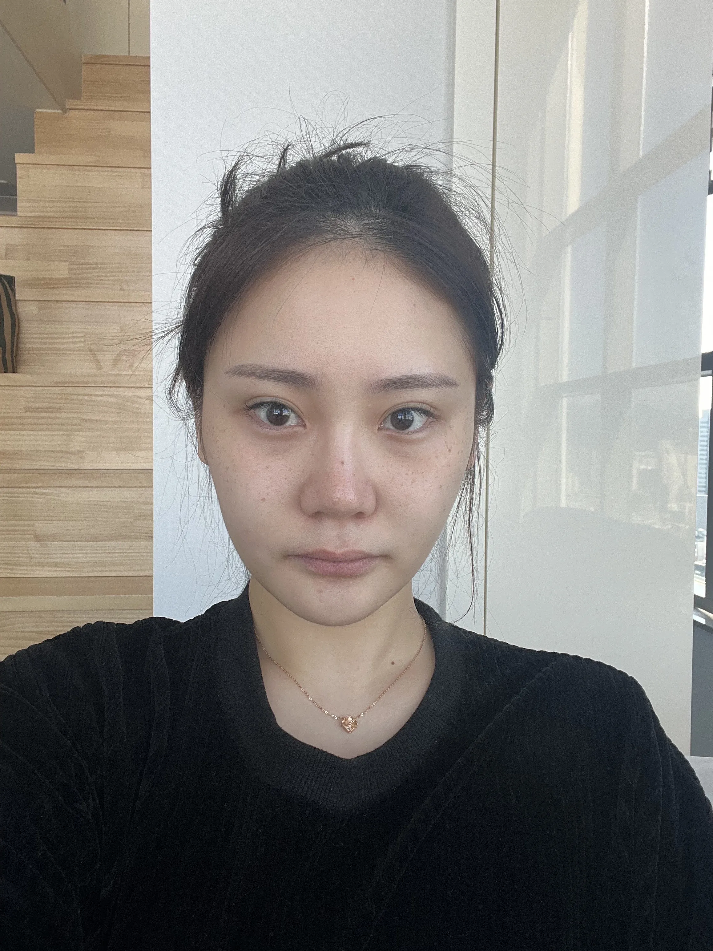 id Hospital - id Real Selfie - ソン・ジウン Before